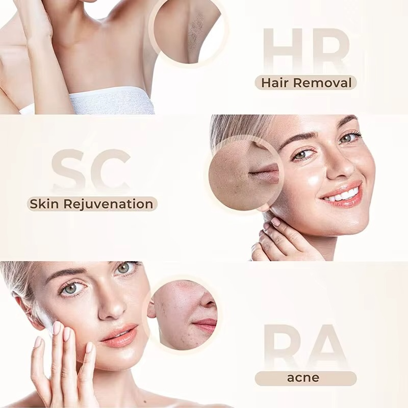 IPL Hair Removal Device